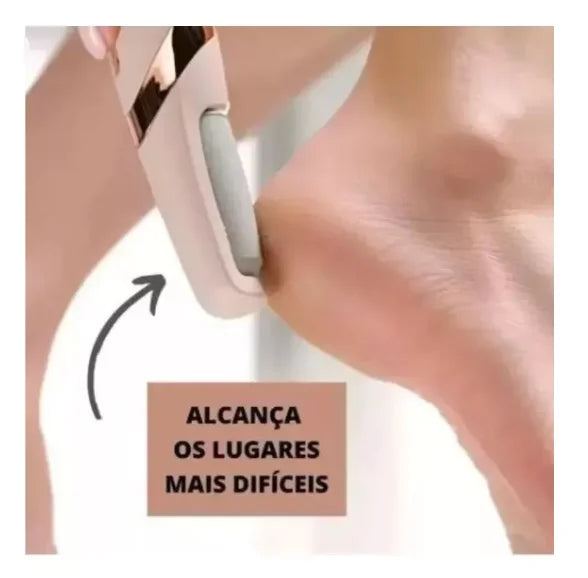Lixadeira Elétrica para Pés Recarregável 360° — Remove Calos e Pele Seca com Facilidade
