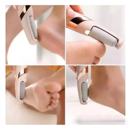 Lixadeira Elétrica para Pés Recarregável 360° — Remove Calos e Pele Seca com Facilidade