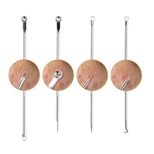 Kit Extrator de Cravo e Espinha Profissional Inox — Limpeza de Pele 360°