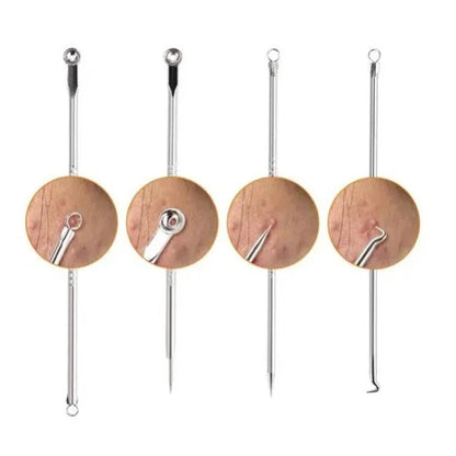 Kit Extrator de Cravo e Espinha Profissional Inox — Limpeza de Pele 360°